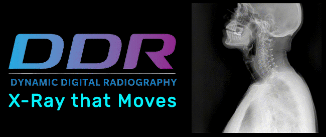 Dynamic Digital Radiology